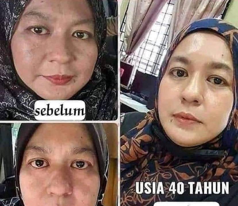 Testimoni